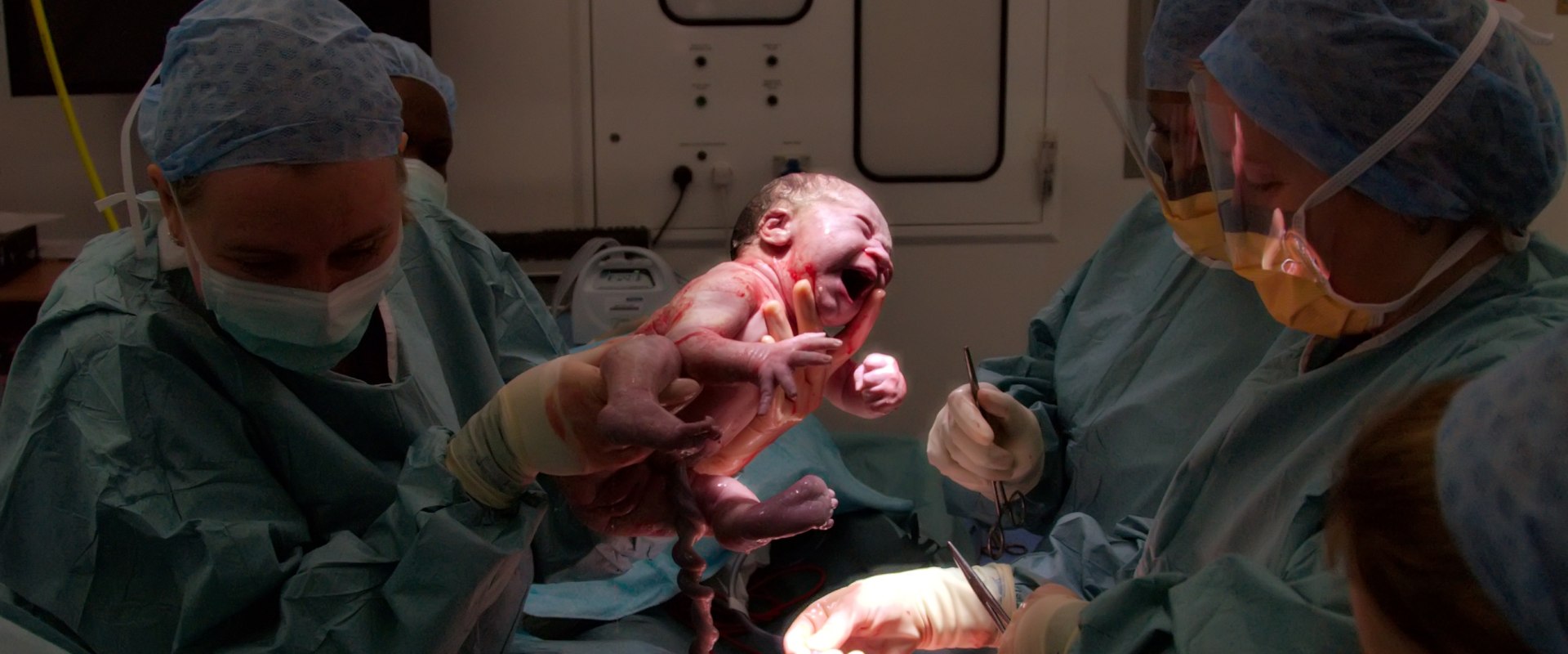 C-Section vs Vaginal Delivery: Which is Right for You?