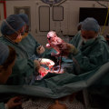 C-Section vs Vaginal Delivery: Which is Right for You?