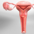 Understanding Hysterectomy: Everything You Need to Know