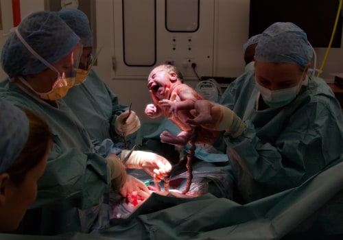 C-Section vs Vaginal Delivery: Which is Right for You?