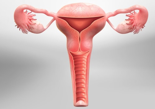 Understanding Hysterectomy: Everything You Need to Know